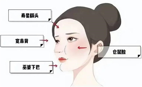 医美烂摊子 “馒化脸”是否有破局之道1.jpg