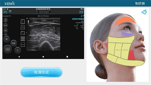 医美烂摊子 “馒化脸”是否有破局之道2.jpg