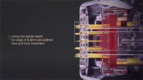 Sylfirm X黑曜双波如何创造皮肤科增量