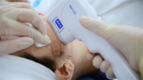 超声仪器政策变动 医美行业未来走向如何？